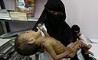 هشدار سازمان ملل درباره به خاطر افتادن جان دو میلیون مادر یمنی