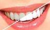 سفید و پر کردن دندان‌ها بدون نیاز به دندانپزشک