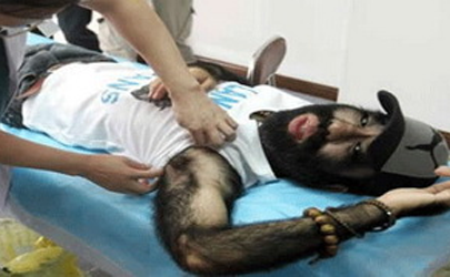 مرد میمونی برای زیبا شدن عمل جراحی می کند!! + تصویر