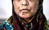 شکنجه های زجرآور زن بی پناه توسط شوهرش/ ۲۱ روز سخت برای دختران 5 و 7 ساله + تصاویر